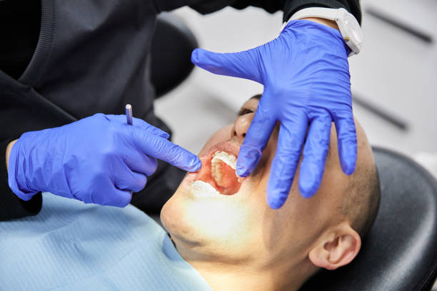 Best Emergency Wisdom Tooth Extraction in Pacheco, CA