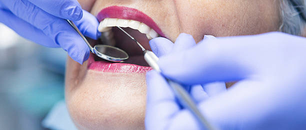 Best Emergency Dental Care for Sports Injuries in Pacheco, CA